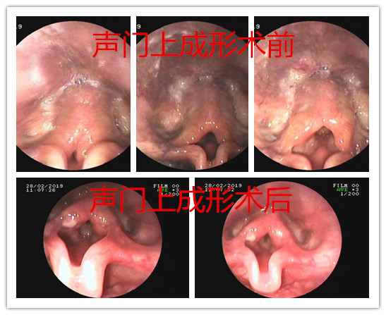 耳鼻咽喉头颈外科- 广东省妇幼保健院 耳鼻咽喉头颈外科- 广东省妇幼保健院