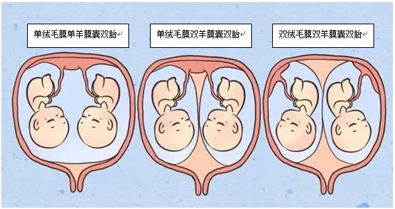 双胎,多胎妊娠门诊 - 广东省妇幼保健院