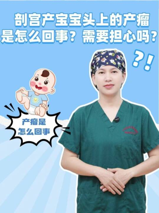 剖宫产宝宝头上的产瘤是怎么回事，需要担心吗？